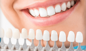 Cosmetic Dentistry in Niceville -Mid Bay Dental