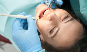 Nursing Disorder Treatment in Niceville-Mid Bay Dental