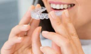 Invisalign For Busy Lifestyles: Balancing Treatment With Daily Demands