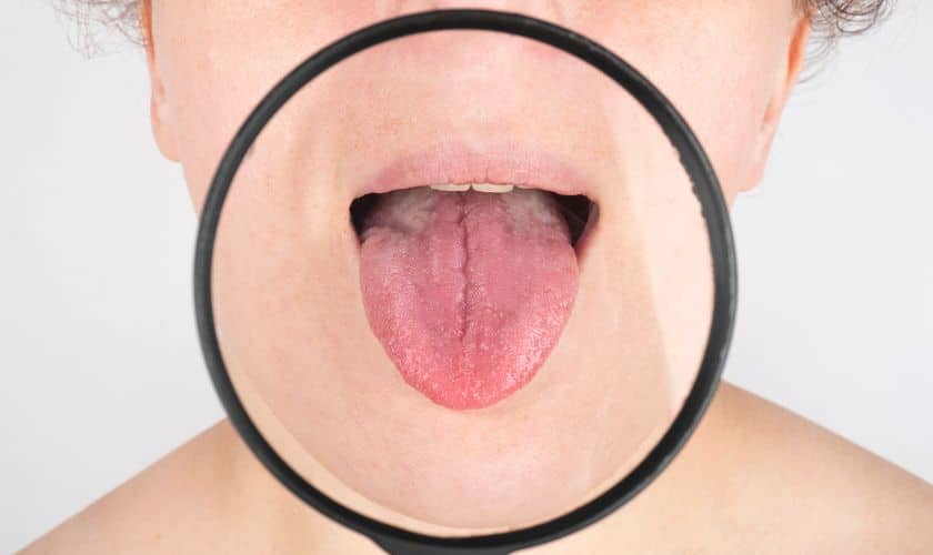 Myths And Misconceptions About Tongue Tie Treatment