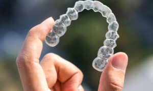 Tips For Cleaning And Maintaining Your Invisalign Aligners