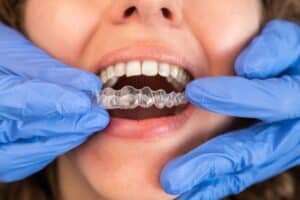 pain with invisalign