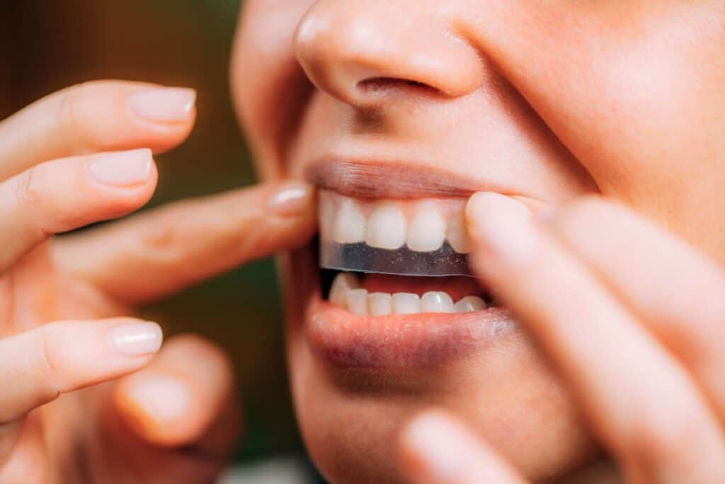 teeth whitening strips