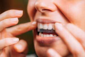 teeth whitening strips