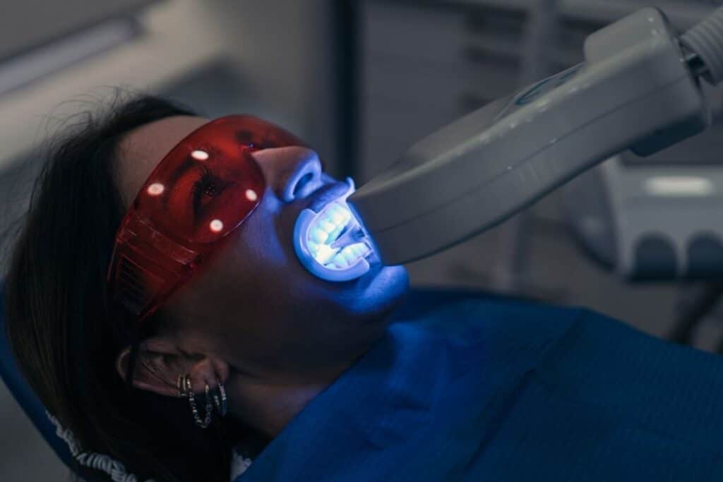 in office teeth whitening for safe enamel
