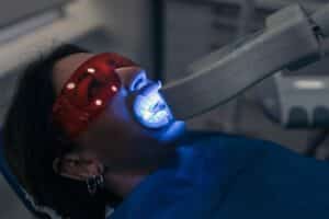 in office teeth whitening for safe enamel