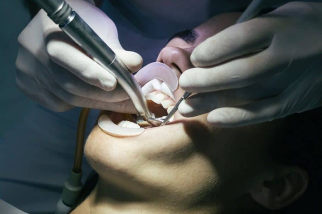 professional dental cleaning