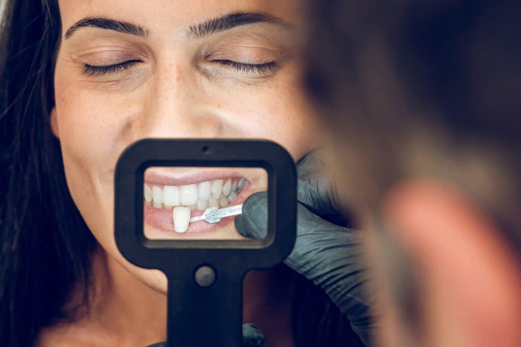 How A Cosmetic Dentist Explains the Benefits of Porcelain Veneers?