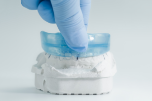 The Role Of Mouthguards In Preventing Dental Injuries