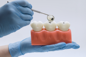 Dental Problems Are Left Untreated