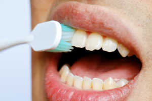 Brushing Your Teeth Too Hard