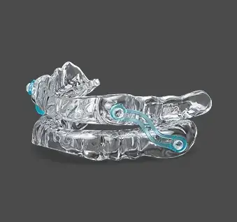 Clear dental sleep apnea oral appliance with turquoise adjustment mechanisms for airway treatment.