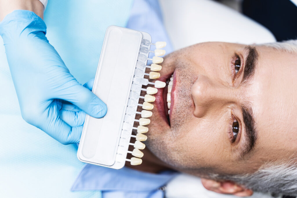 Veneers in Niceville